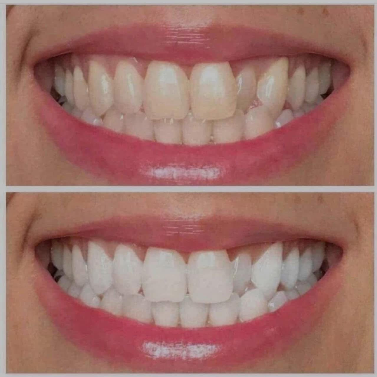 PRE-ORDER: Ultraviolet Pearly Whites Brightening Gel